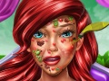 खेल Princess Mermaid Skin Doctor