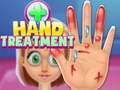 खेल Hand Treatment